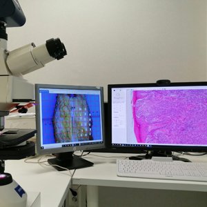 Histopathological Analysis and Research